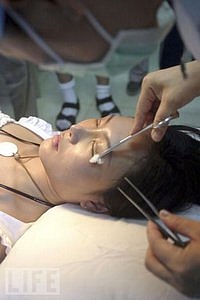 WEALTHY folks in China are willing to go under the knife for a unique appearance.